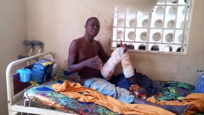 A young man sits on a bed in the isolated room at the Kabala Government Hospital, Sierra Leone, his injured leg bandaged and crutches beside him, explaining his situation to Mohamed Jalloh.